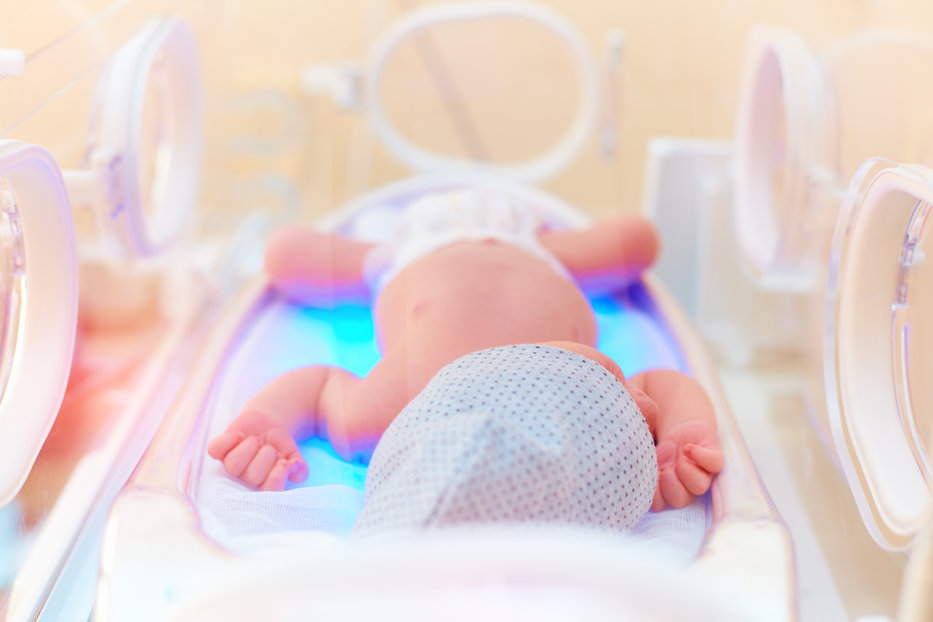 Ante el nacimiento de un bebé prematuro